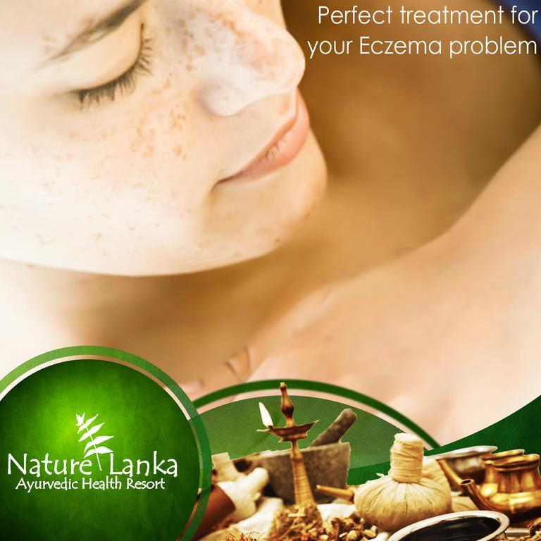 Nature Lanka Ayurveda Resort - All Meals And Ayurveda Treatments With Yoga Tangalle Εξωτερικό φωτογραφία